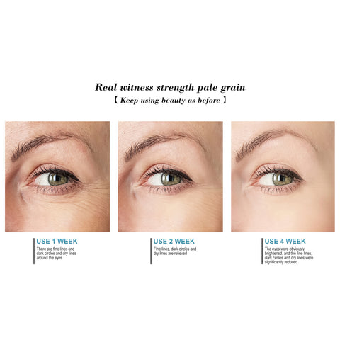 Anti-Aging Retinol Eye Cream with Aloe, Hyaluronic Acid & Vitamin E Hydrating Eye Cream for the Appearance of Fine Lines, Puffiness, Dark Circles & Dry Skin | 0.7 fl oz
