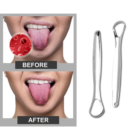 4-Pack Stainless Steel Tongue Scraper Cleaner – Durable Oral Hygiene Tool for Fresh Breath & Daily Tongue Cleaning