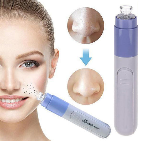 Facial Pore Cleanser – Battery-Operated Suction Skin-Care Tool, 1-Pack or 2-Pack