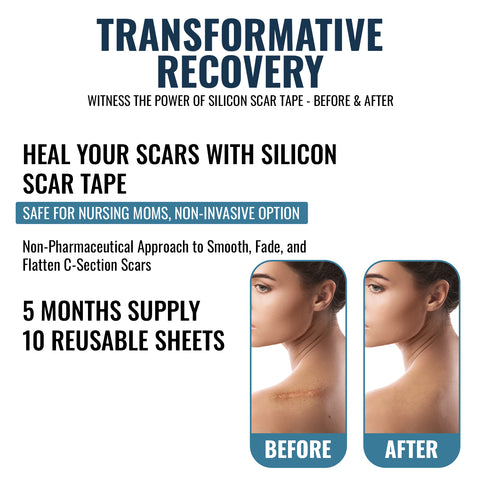Scar Away Silicone Scar Sheets Tape (5.9"X 1.6”) Removal For Surgical, Keloid, C-Section, Acne Burns & Tummy Tuck Scars (10 Sheets)