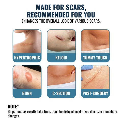 Scar Away Silicone Scar Sheets Tape (5.9"X 1.6”) Removal For Surgical, Keloid, C-Section, Acne Burns & Tummy Tuck Scars (10 Sheets)